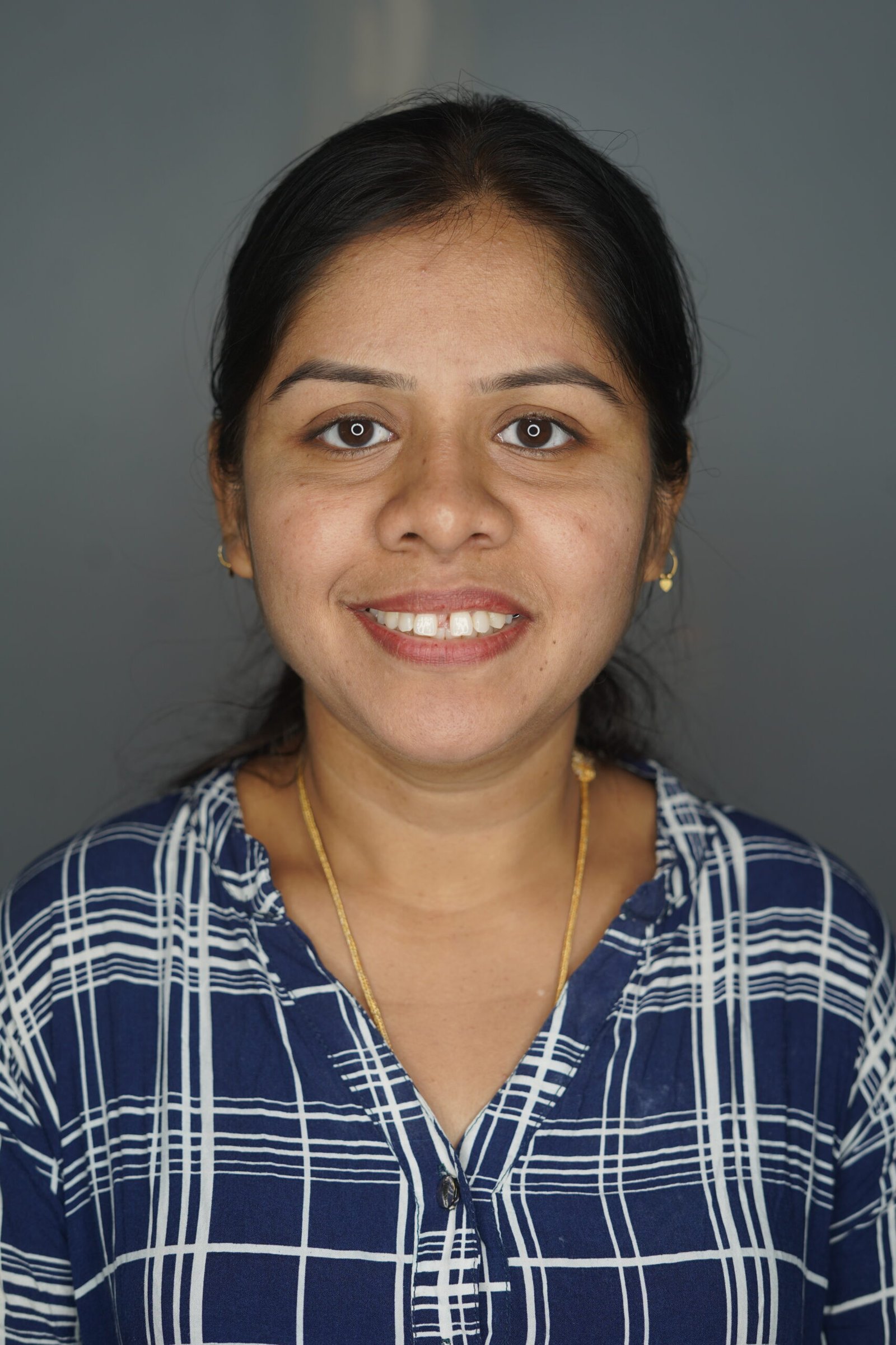 Before — Smile makeover