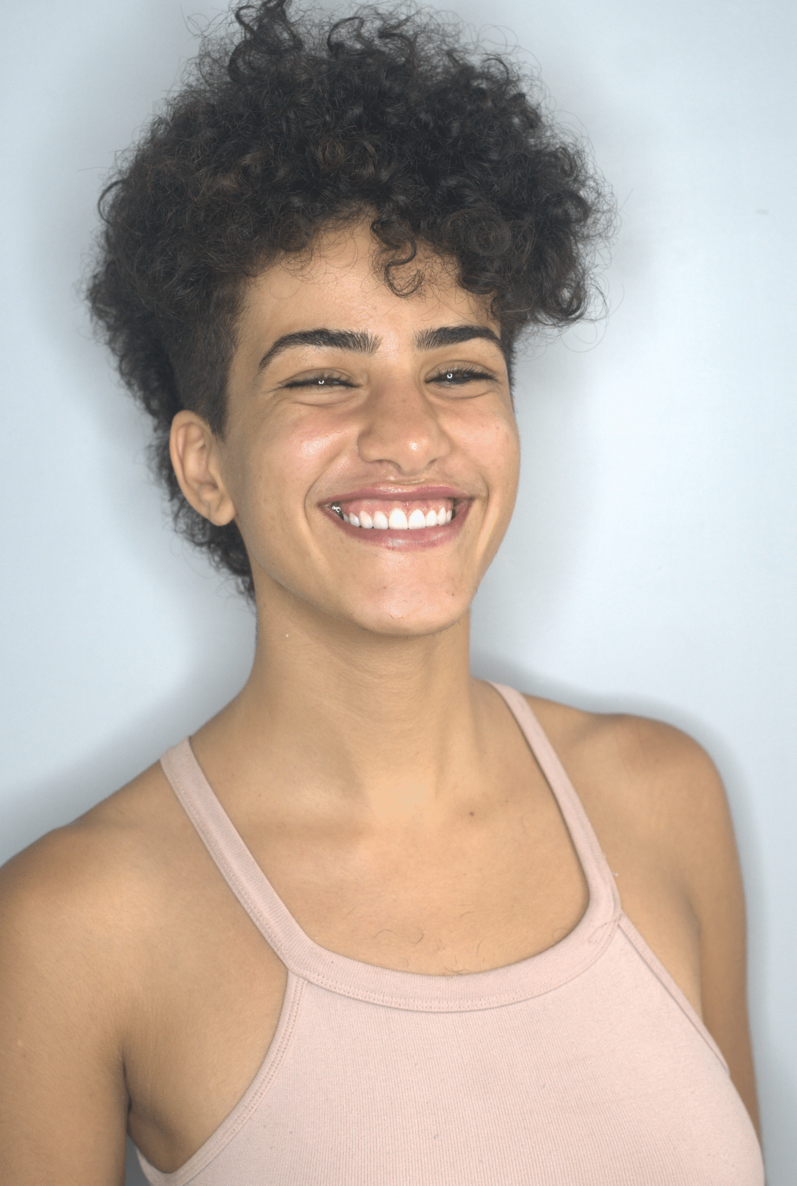 After — Smile makeover
