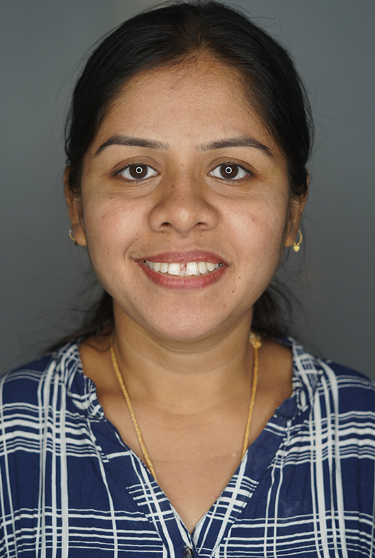 Before — Smile makeover