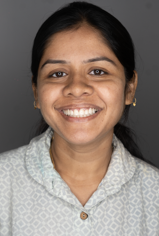 After — Smile makeover