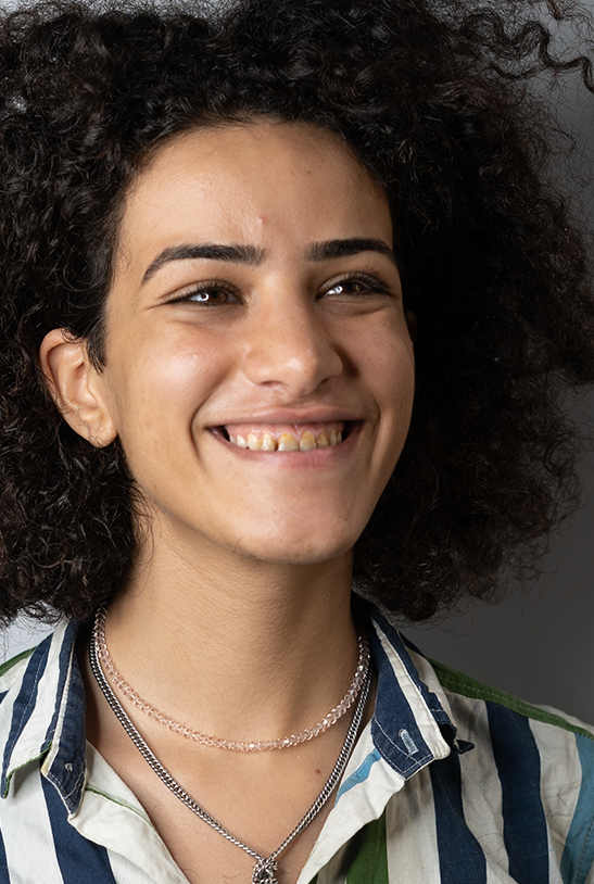 Before — Smile makeover