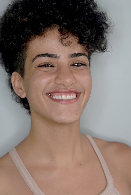 After — Smile makeover